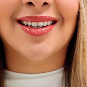 Gloss 5